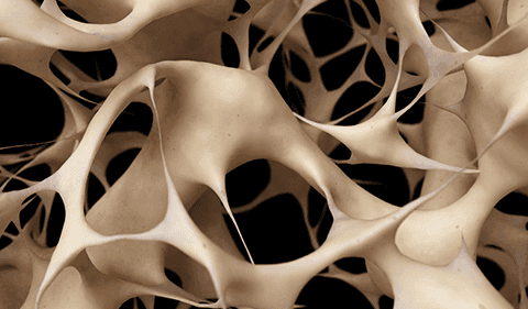 Curso de OSTEOPOROSIS